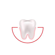 How often do you experience bleeding while brushing or flossing?
