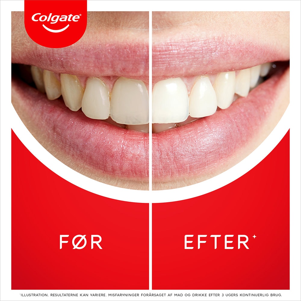 Colgate® Max White Ultra Active Foam